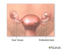 Anatomy of the pelvic floor. Pelvic Laparoscopy Series Indications Medlineplus Medical Encyclopedia