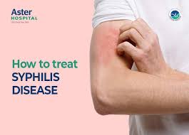 Image result for syphilis symptoms