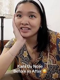Kyla Dy