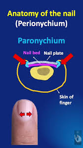 Image result for paronychium