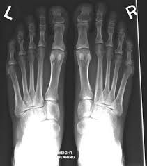 The Roders Connected To The Leg Bone Leg Bones X Ray Feet