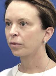 Cases in COSMETIC SURGICAL