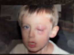 Kody's behavior towards Mykelti after horse accident