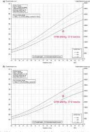 Figure 3 From Fetal Growth Surveillance Current Guidelines