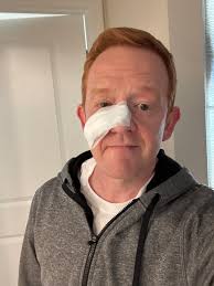 A quick note to say that I will be missing from TV for a little while...  Back around the holidays, I noticed what I first thought was a pimple just  below my