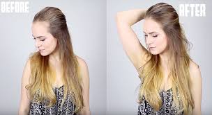 Worst hairstyles for hair loss in women. With Four Easy Tricks You Can Make Your Receding Hairline Disappear In An Instant See How You Can Transform Your Look In The Video