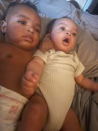 Surprise discovery of twins at 6 months pregnant