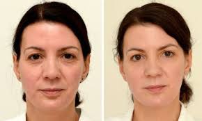 Fill the four liter and dump into 3 liter until full. How Drinking Three Litres Of Water A Day Took Ten Years Off My Face Daily Mail Online