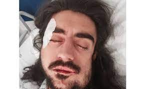 63.344 curtidas · 35 falando sobre isso. Toda A Verdade Sobre As Agressoes Violentas Ao Ator Diogo Fialho Nacional Flash