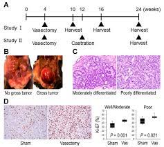 The hormones that your thyroid gland produces help regulate several of your bodily functions. Cancers Free Full Text Impact Of Vasectomy On The Development And Progression Of Prostate Cancer Preclinical Evidence