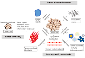 Tumor Progression Dependent Angiogenesis In Gastric Cancer