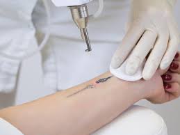 Chemicals in tattoo ink travel in the bloodstream and accumulate in the lymph nodes, which may cause them to become swollen and therefore. Do Black Light Tattoos Cause Cancer