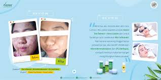 Bayangkan aja waktu itu 7 hari 6 malam tidak mandi, makan seadanya, wajah berlumur bedak dingin, cuci muka aja tidak bisa, air bersih pun susah. Larissa Aesthetic Center