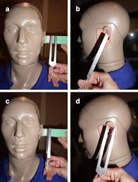 Image result for Tuning Fork Test