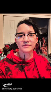 Effective Home Remedies for Eczema and Nail Fungus