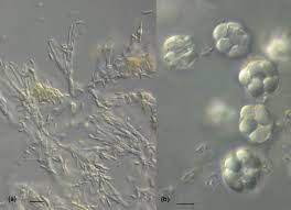 Byssochlamys Fulva An Overview Sciencedirect Topics