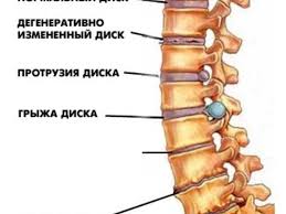 ÐÐ°ÑÑÐ¸Ð½ÐºÐ¸ Ð¿Ð¾ Ð·Ð°Ð¿ÑÐ¾ÑÑ Ð³ÑÑÐ¶Ð¸ Ð² ÑÐ¿Ð¸Ð½Ðµ