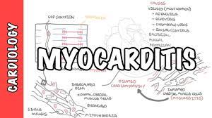 In both cases, the body's immune system is causing inflammation in response to an infection or some other trigger. Myocarditis Causes Pathophysiology Investigation And Treatment Youtube