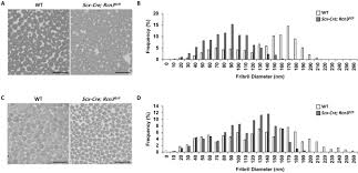 We did not find results for: Reticulocalbin 3 Is Involved In Postnatal Tendon Development By Regulating Collagen Fibrillogenesis And Cellular Maturation Scientific Reports