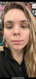 Esthetics With Emma 💫 Model Call! Limited Spots 💫 Thinking about trying a  new service? Now's your chance! 🤍 Book one (or a few 😉) of my amazing  treatments at a special