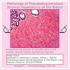 Pin On Systemic Pathology Medicine