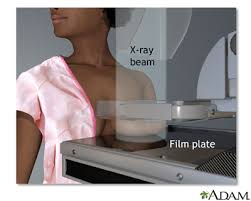 Apr 08, 2019 · it recommends the majority of women get a mammogram every other year beginning at age 50 and younger women should speak to their doctors about the benefits. Mammogram Lima Memorial Health System