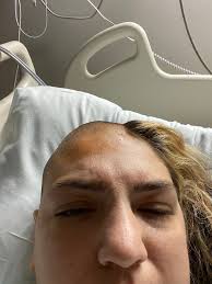 Howl for me y'all! July 27th I went unconscious in the shower and my 3yr  old Puppers Emma May pulled me out by the head of my hair... after a few  hours