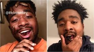 慎入！男子超愛昆蟲一張嘴…蜘蛛、蟑螂爬出來│TVBS新聞網