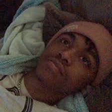 Patient presents with pain and swelling in the hand. X-ray shows this. What  is your diagnosis?