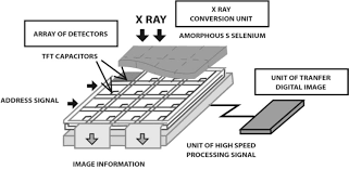These smart x ray flat panel detector are portable and digital devices that are automated and aids in attaining sharp images through the available perfect these x ray flat panel detector are equipped with features such as advanced ccd cameras with noise reduction algorithms for providing optimum. Digital Radiography Book Chapter Iopscience