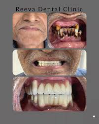 Dr Nakul Patel (@reevadentalclinic) • Instagram photos and videos