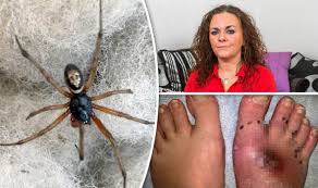 The false black widow spiders (also known as false katipo, false button spider, cupboard spider, and in australia, brown house spider) are spiders the bite of steatoda grossa may cause nausea, widespread but short lived pain, muscle spasms, and malaise; Mother Of Five Could Lose Foot After False Widow Spider Bite Uk News Express Co Uk