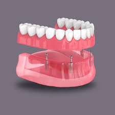 Image result for dentures