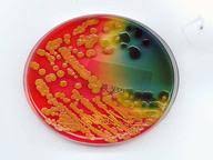 Buzzfeed staff the more wrong answers. The Genetics Of Viruses And Bacteria Quiz 10 Questions