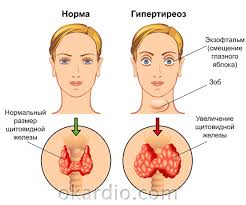 Ot Chego Ponizhennoe Verhnee Davlenie Kak I Chem Povysit Verhnee Sistolicheskoe Davlenie V Domashnih Usloviyah Nizkoe Verhnee Arterialnoe Davlenie Prichiny I Lechenie Aritmii I Poroki Klapanov