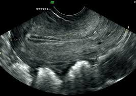 We did not find results for: Pelvic Ultrasound Scans For Women In London Ultrasound Services