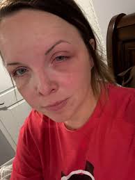 Ugh…😭😭 I HATTEEE to do this, but I will be closed again tomorrow! The  doctor said today that I wasn't out of the woods yet but, she thinks we are  starting to