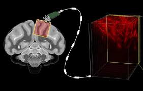 September 8, 2013july 19, 2017 jithin 0 comments academics, seminars. Reading Minds With Ultrasound Caltech S New Brain Machine Interface