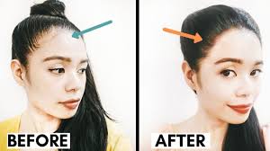 Short hairstyles for receding hairline Methods I M Using To Grow Back A Fuller Hairline Receding Hairline Regrowth Beautyklove Youtube