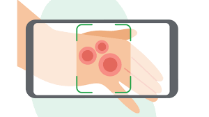 Check spelling or type a new query. Google Ai Tool Can Help Patients Identify Skin Conditions Bbc News