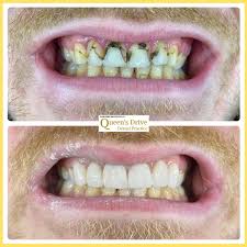 And/or (c) operate equipment and reach for instruments and supplies. Smilefast Twitter Search