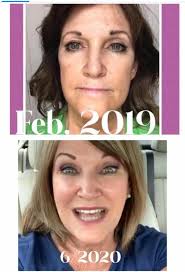 Skins First Episode Release Announcement