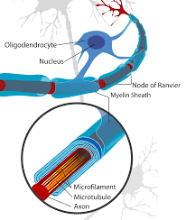 Mutation Story Canavan Disease Zayd S Blog