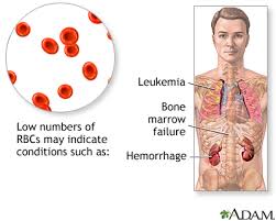 Complete Blood Count Series Results Part 1 Medlineplus Medical Encyclopedia