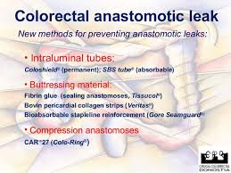 Some results of colo colonic anastomosis cpt code only suit for specific products, so make sure all the. Colorectal Anastomosis Leakeage Sorrento 2010