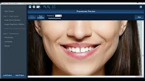 (Permission to post please), See the DTS Software in full flow! , From  Digital smile designing to Orthodontic simulations to composite bondings to  Gingivectomies to smile makeovers to extraoral ...