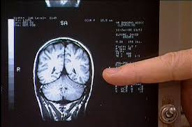 27 juegos mentales para ejercitar el cerebro (adultos y niños) seguramente conozcas los típicos pasatiempos para ejercitar la mente, como las sopa de letras, o los crucigramas. Cuando La Quimio Nubla La Mente Salud El Mundo