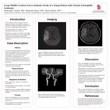 Basically cva provides important and comprehensive information about the effectiveness of a school. Pdf Large Middle Cerebral Artery Ischemic Stroke In A Very Young Patient With Chronic Eosinophilic Leukemia Maheedhar Gedela Academia Edu