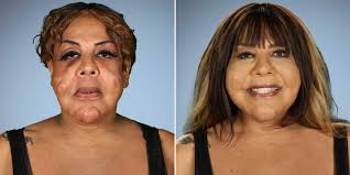 Plastic surgery procedures started as medical treatments but grew into cosmetic surgeries. What To Know Before Getting Cosmetic Surgery How To Research Your Plastic Surgeon