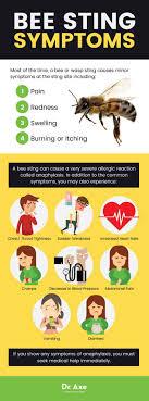 7 Home Remedies For Bee Stings In 2020 Remedies For Bee Stings Bee Sting Symptoms Wasp Sting Remedy